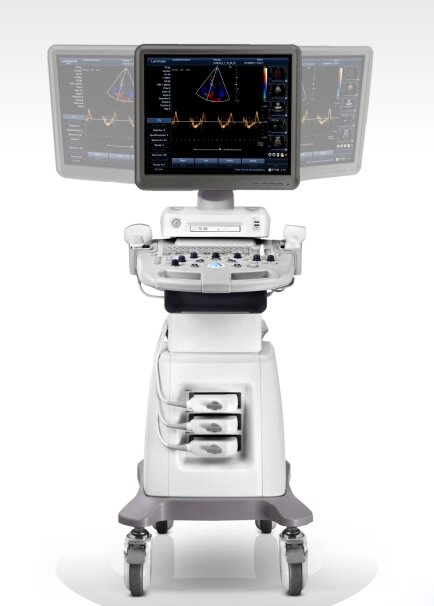 Ультразвуковой диагностический сканер на платформе EX20c, УЗИ аппарат (Китай) - обзор