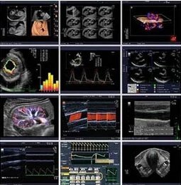 Ультразвуковые диагностические сканеры (УЗИ)