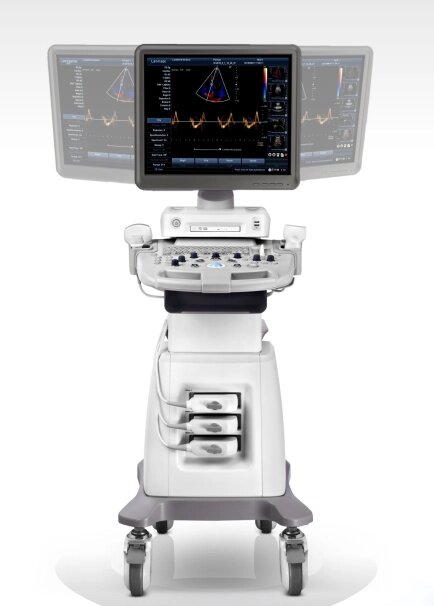 Ультразвуковой диагностический сканер на платформе EX20c, УЗИ аппарат (Китай) от компании ТОО Искра Трэйдинг - фото 1