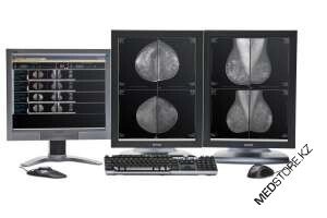Диагностическая станция MammoDiagnost VU