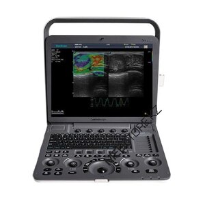 Система для ультразвуковой диагностики SonoScape S9Pro ( VISTA-платформа)