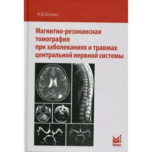 Магнитно-резонансная томография при заболеваниях и травмах центральной нервной системы. 2-е издание. Холин А. В.