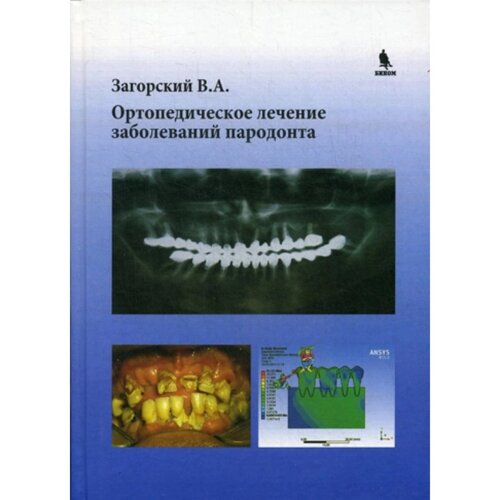 Ортопедическое лечение заболеваний пародонта. Загорский В. А.