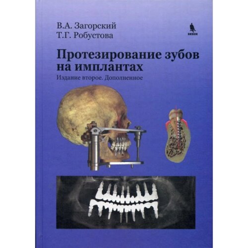 Протезирование зубов на имплантатах. 2-е издание, дополненное. Робустова Т. Г., Загорский В. А.