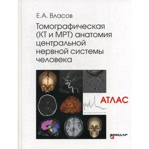Томографическая (КТ и МРТ) анатомия центральной нервной системы человека. Атлас. Власов Е. А.