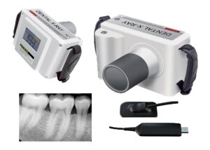 Ренген Dental X-Ray + Визиограф